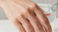 hard water affects skin