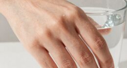 hard water affects skin